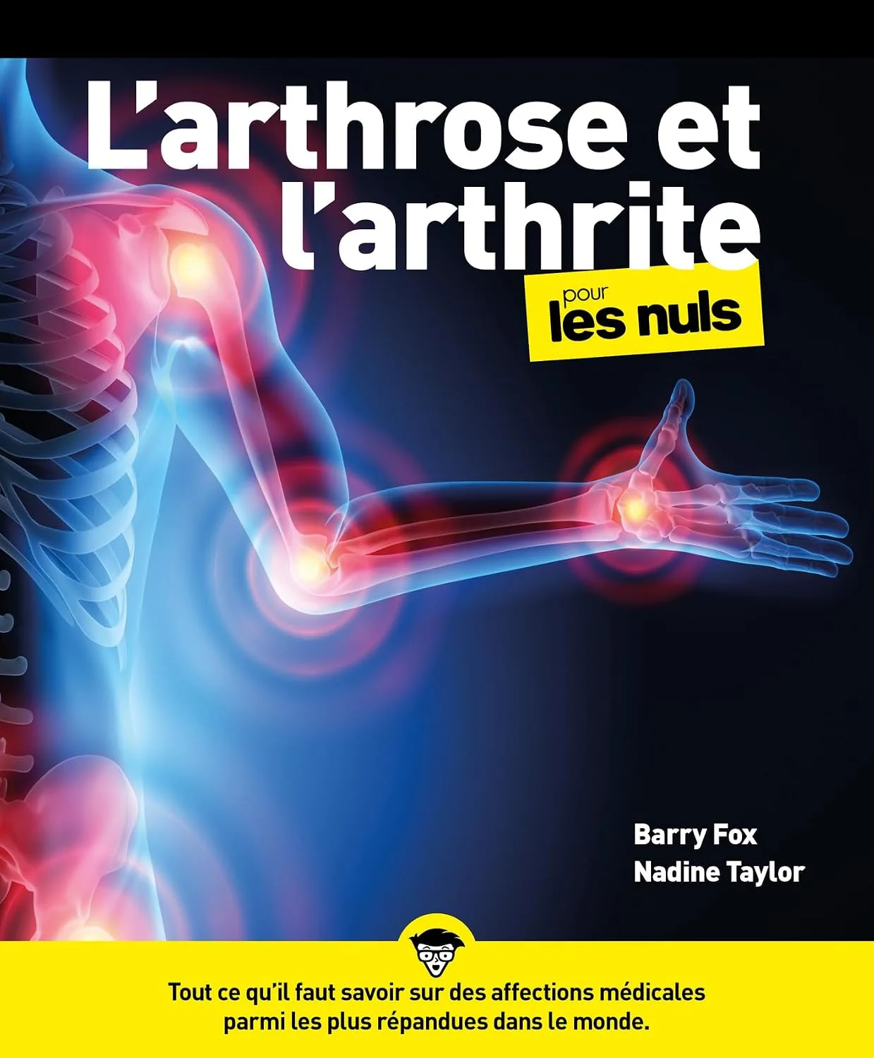 1001Ebooks - L'arthrose et l'arthrite Pour les Nuls L'arthrose et l'arthrite Pour les Nuls